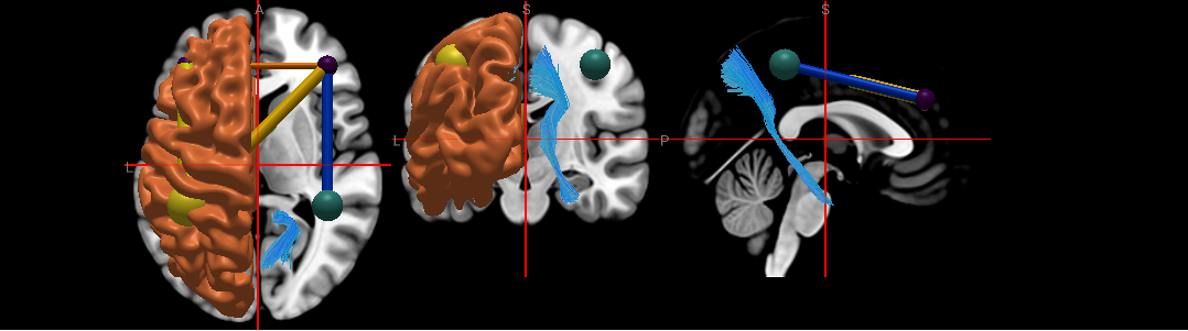 basic.vox.connect.ipynb thumbnail