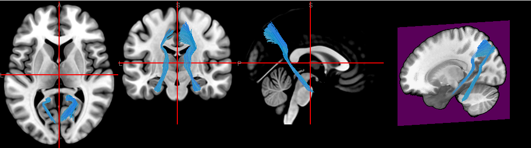 basic.vox.tract.ipynb thumbnail