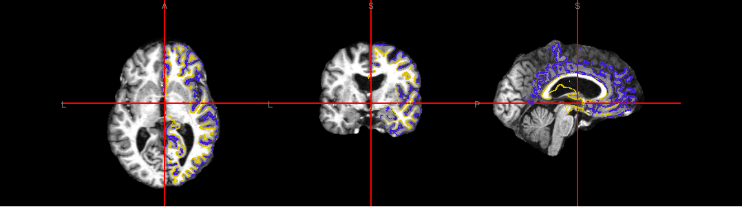 freesurfer.ipynb thumbnail