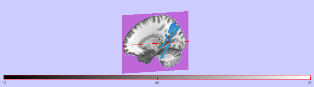 tracts.ipynb thumbnail