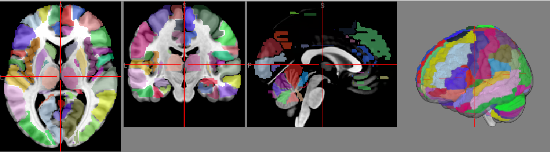 vox.atlas.ipynb thumbnail