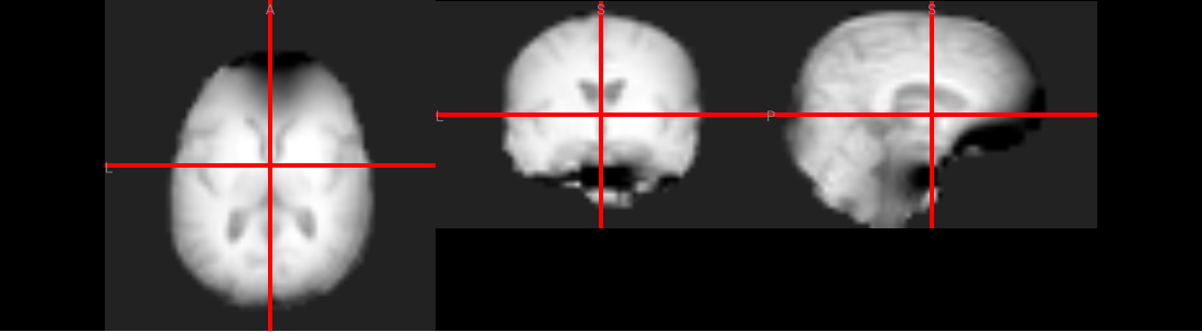 vox.complex.ipynb thumbnail